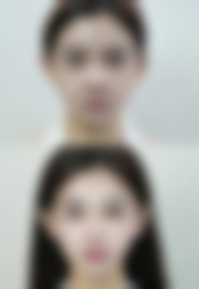 肚子大抽脂会反弹吗?术后护理黄金法则大揭秘