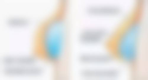 冰敷眼睛消除眼袋的科学依据：探究低温魔法背后的奥秘