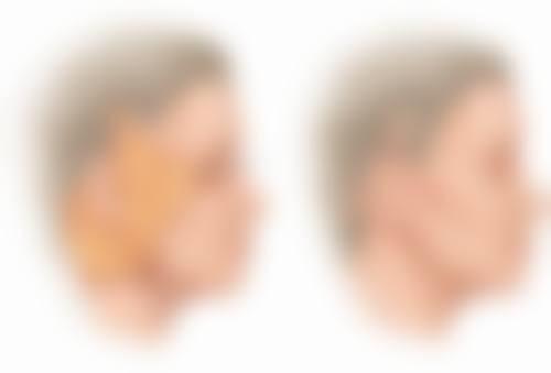 金明勋医生做手术价格