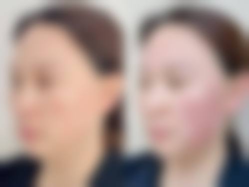 武汉斯启诺医疗美容门诊部王伟民收费价目表之斯启诺门诊部的环境与服务体验