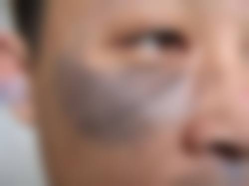 遵义市第一人民医院(烧伤整形手显微外科)地址及乘车路线