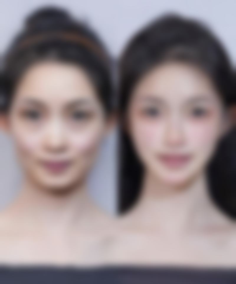 冰敷眼睛消除眼袋的潜在风险：美丽背后需谨慎