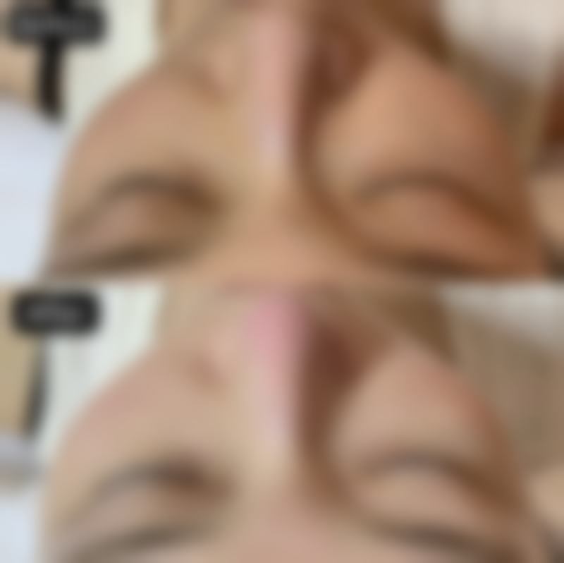 金明勋医生项目优势