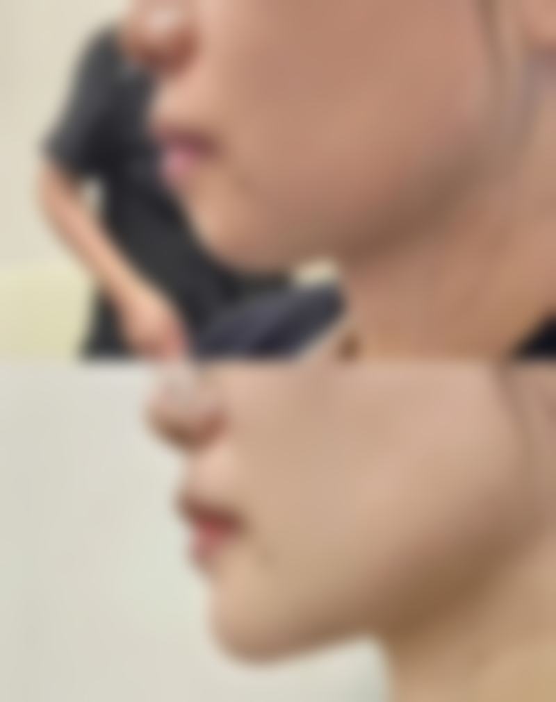 其他医美行业乱象