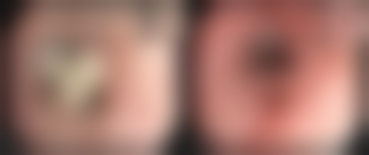 西安科医颜整形医院口碑好不好?附真实患者口碑评价