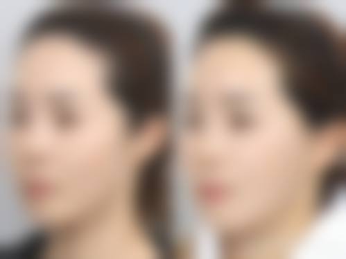 宁波媛容会整形医院口碑好不好