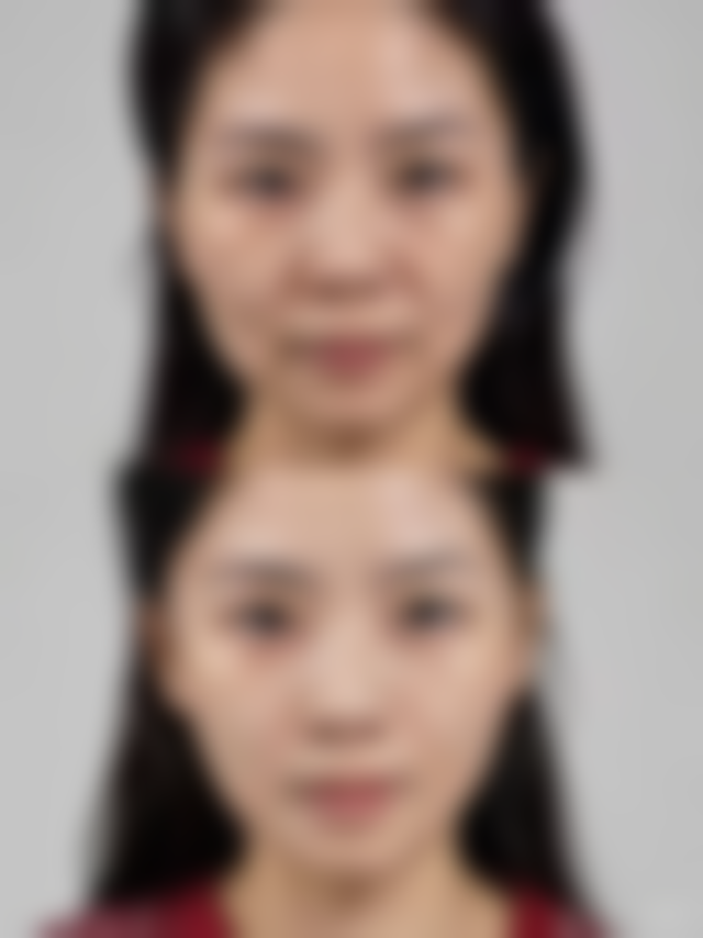 南京奇致整形医院怎么样：项目特色