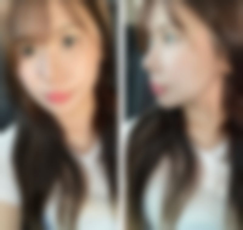 本溪极美医疗美容诊所更擅长什么