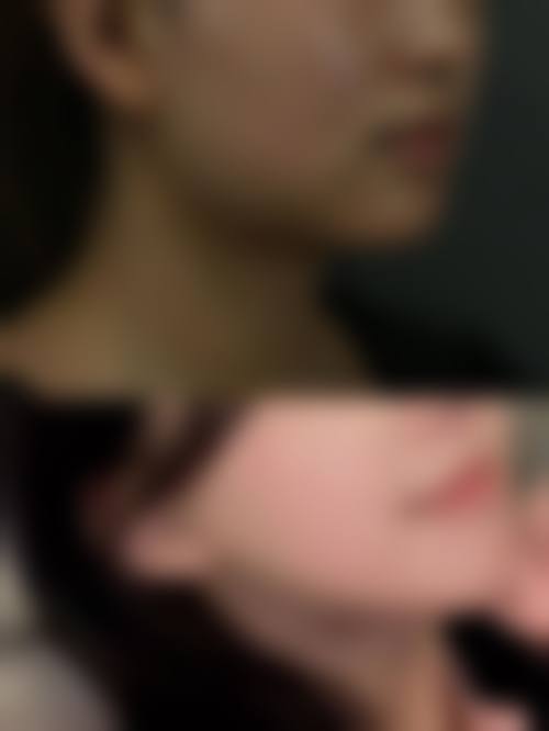 许昌正美韶华医疗整形韦婷2026坐诊相关——许昌博爱整形美容医院