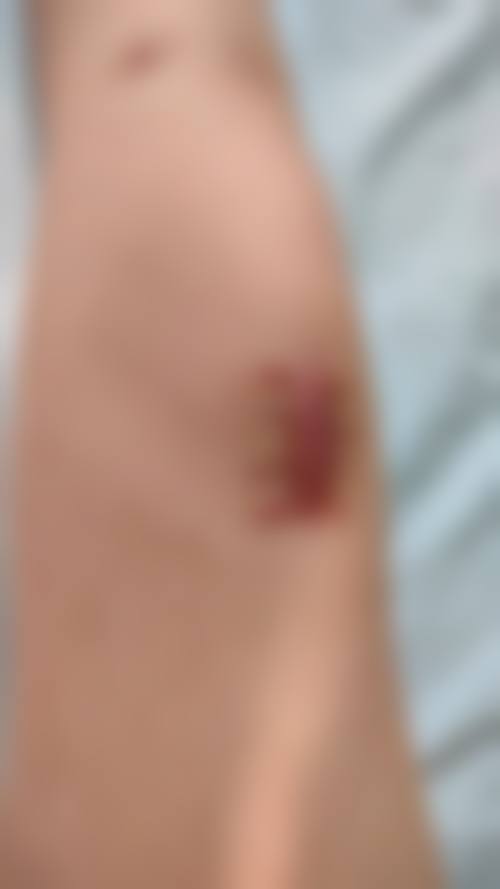 天津丽身小华医疗美容诊所更擅长什么手术