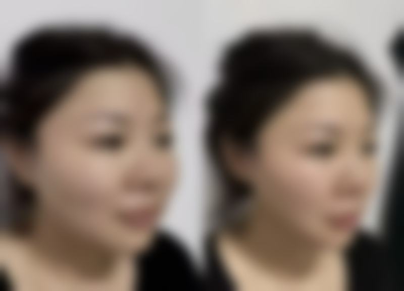 张永医生简介做手术价格