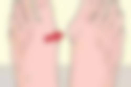 李相喆医生口碑如何