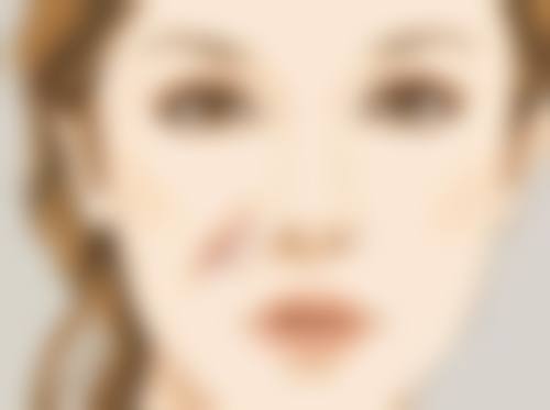 六、割个双眼皮留疤能消除吗?希望与现实的平衡