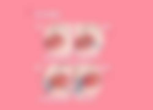 埋线双眼皮一个宽一个窄的黄金修复期与修复概率