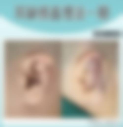 西宁仁爱医院整形外科价格表