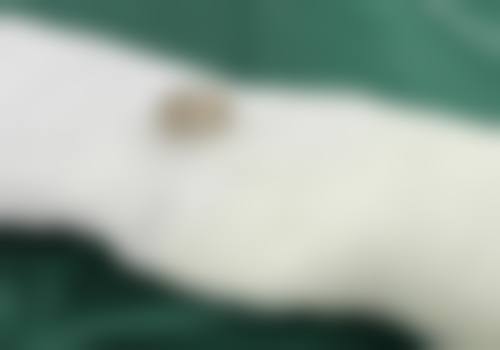 成都爱海斯医疗美容门诊部更擅长什么