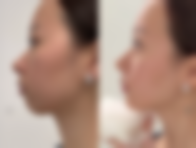 眼袋发黑怎么调理之饮食科学调理：吃出明亮双眸