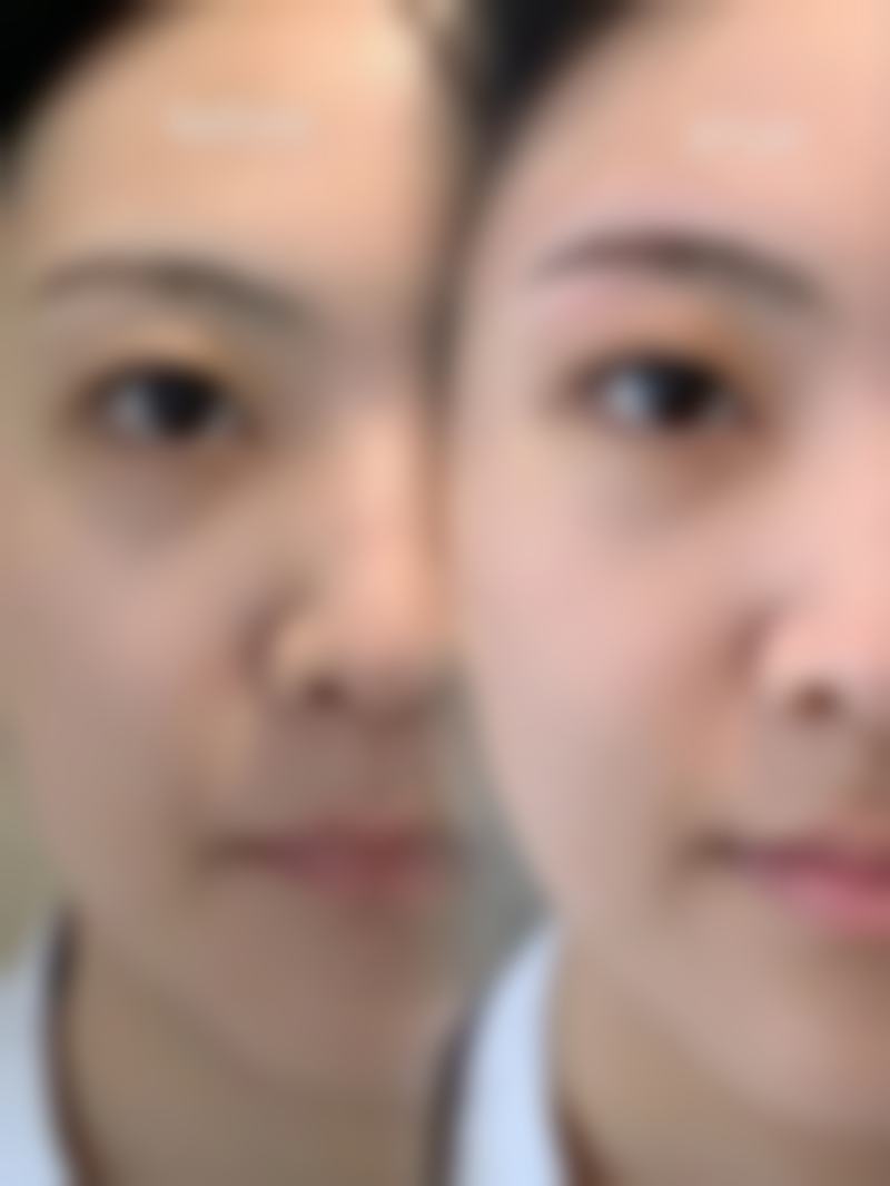 廖晓芸医生项目优势