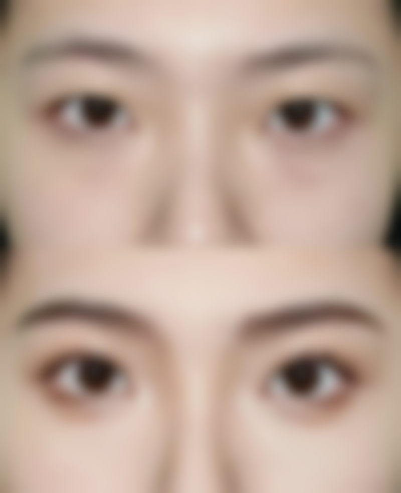 廖晓芸医生做手术价格