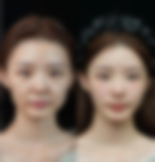 李相喆医生顾客实例图片