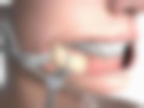 药物修复：内外兼治疤痕疙瘩的“调理师”