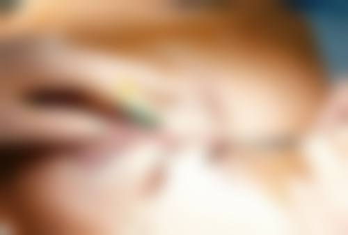 怎么修复妊娠纹成效好：重拾光滑肚皮不是梦