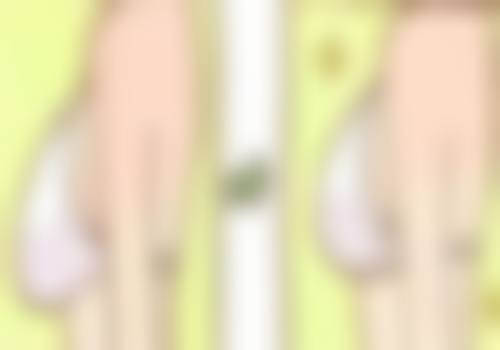 激光修复：辅助治疗疤痕疙瘩的“美容师”