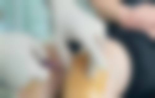 孟佑在医生做手术价格