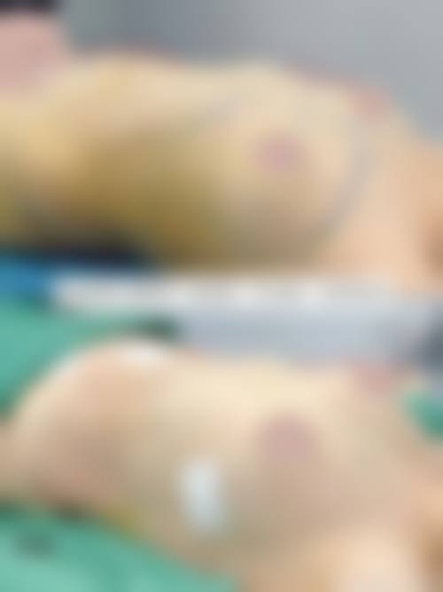 湖南美辰医疗美容有限公司抖音团购活动有哪些，价格表