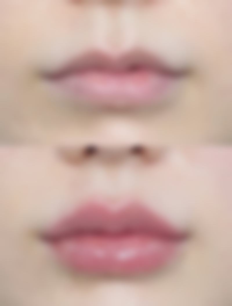 如何将做假体隆胸的风险降到较低:聪明女孩的选择指南