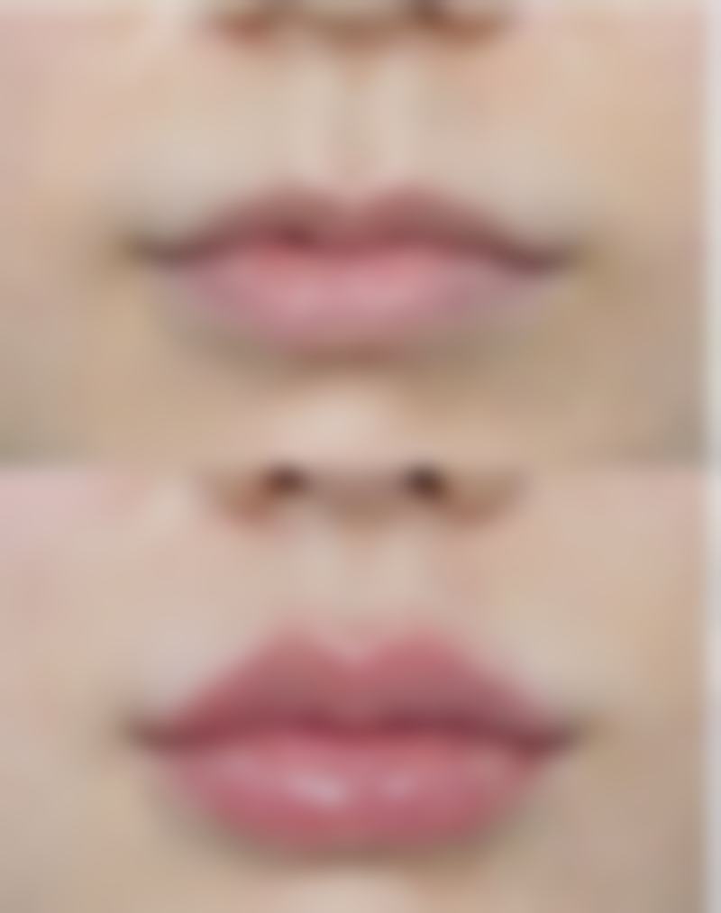 怎么修复疤痕控制成本成效好：投资美丽的成本