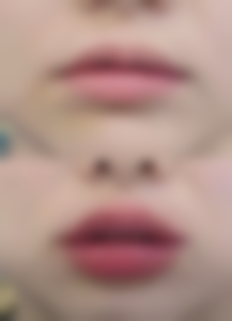 红旗亚星智美医疗美容门诊部顾客实例分享