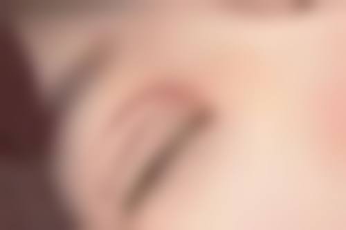 隆鼻山根高带来的危害：不能忍的苦恼