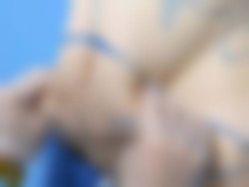 隆鼻山根高怎么办：六大解决方案总有一种适合你