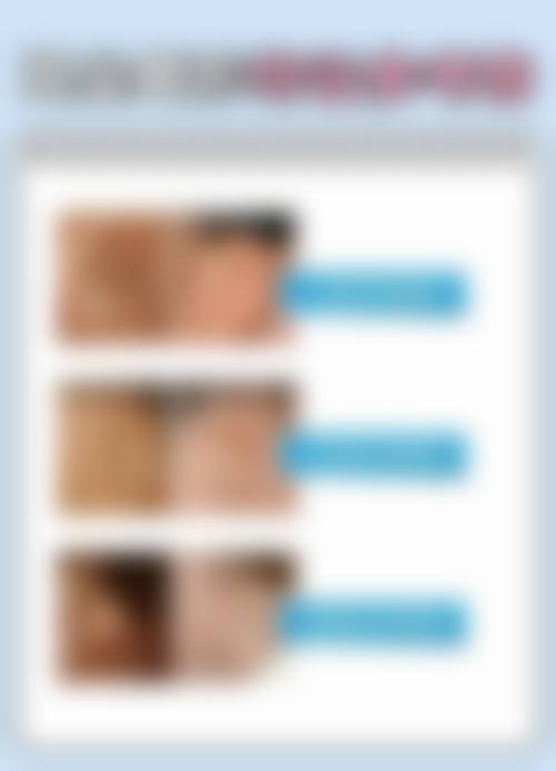 金华芙洛拉医疗美容门诊部特色项目有哪些