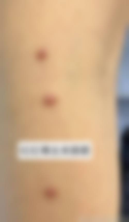 苏连菊医生口碑如何