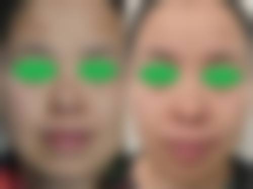 许昌市郝文玉收费一览表——南京美贝尔美容医院