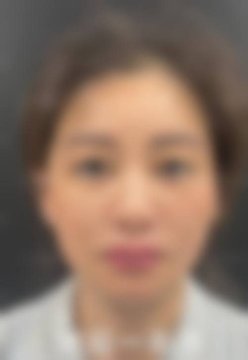 苏连菊医生做手术价格