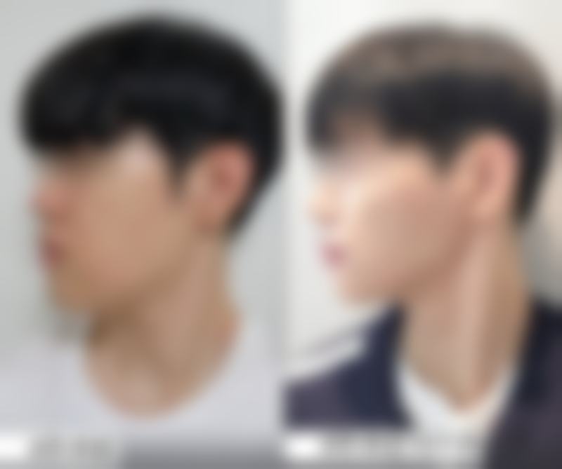 六、河南商丘芮颜整形医院怎么样——真实患者口碑评价