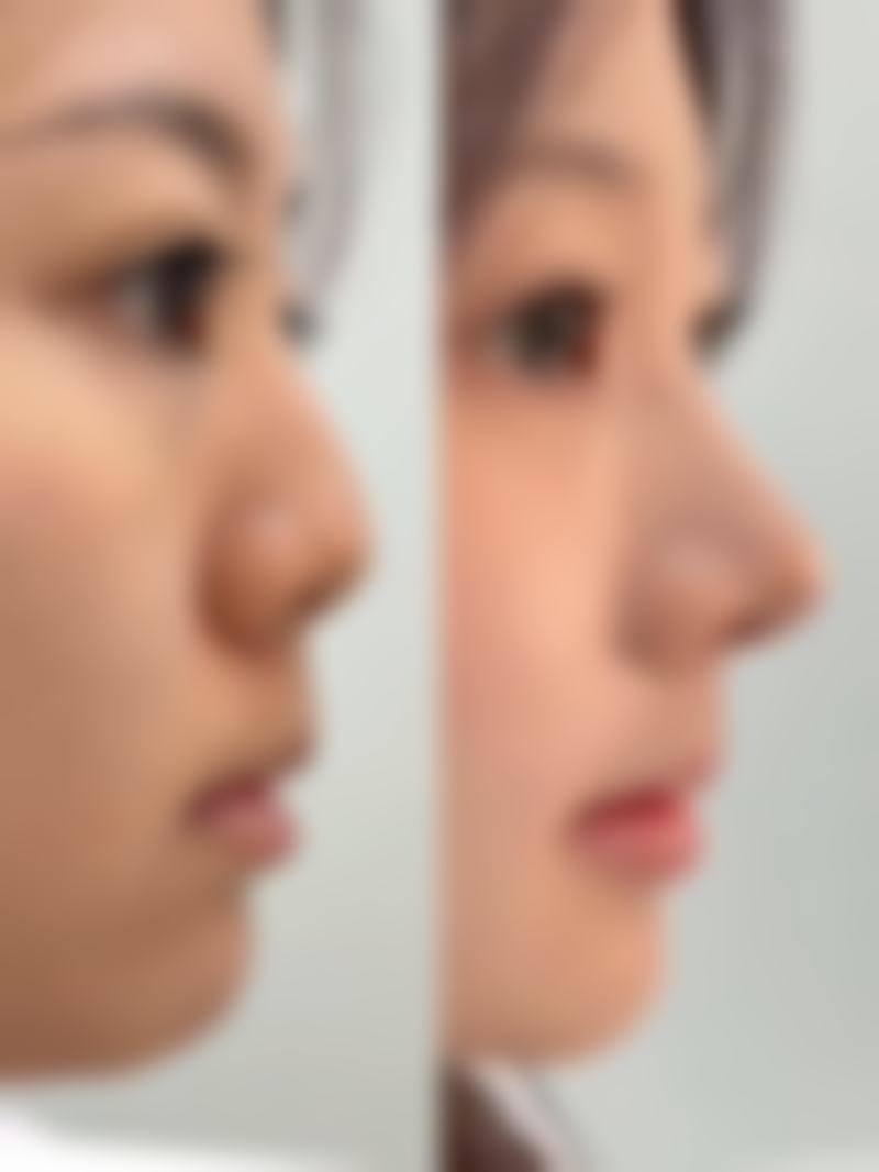 哈尔滨大庆希美尚颜整形是否正规