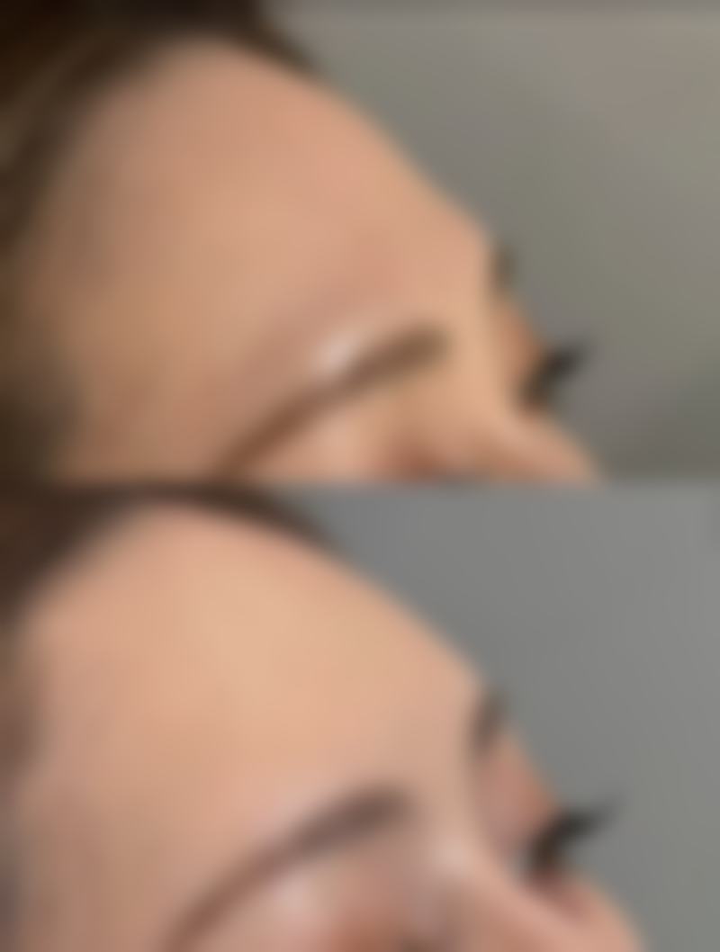 消除眼袋的10种方法有哪些——日常护理细节：呵护眼部每一刻