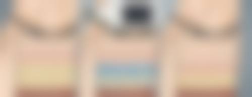 预防油烫伤:避免疤痕产生的关键