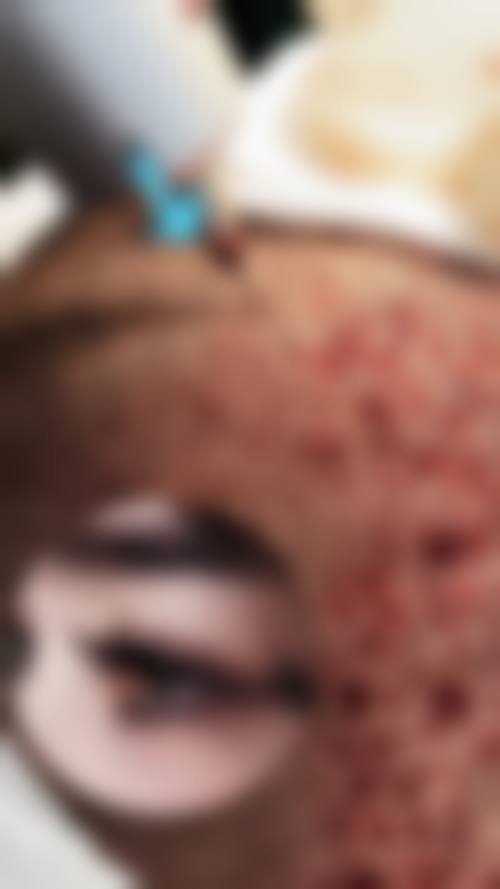 广西民族医院医学美容科口碑评价