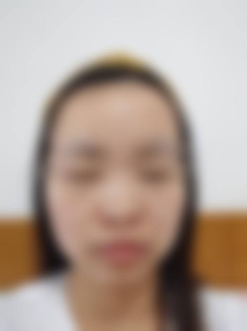 广西民族医院医学美容科项目特色