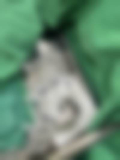 S女性医院李惠妍医生440 - 615万韩币缩阴手术的靠谱性研究