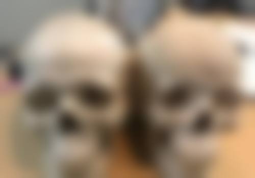 修复烫伤疤痕的办法有哪些——药物修复篇