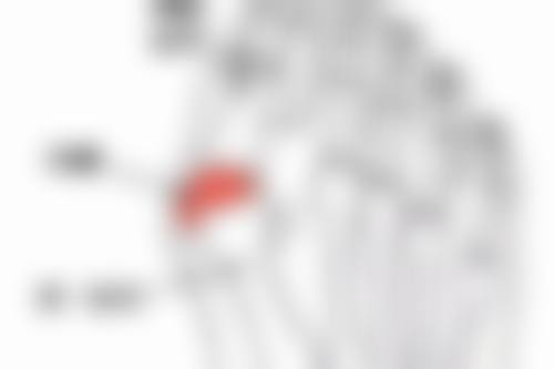 双眼皮增生用疤克多久能去掉——时间表详细公开