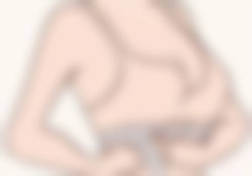 双眼皮增生用疤克能去掉吗？拆线后3天涂抹效果最佳，坚持3个月淡化明显