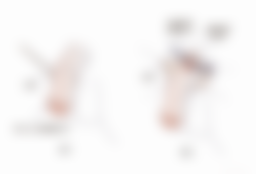 刘丽琴医生简介做手术价格