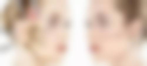 补充胶原蛋白去眼袋有副作用吗：安心护肤需谨慎